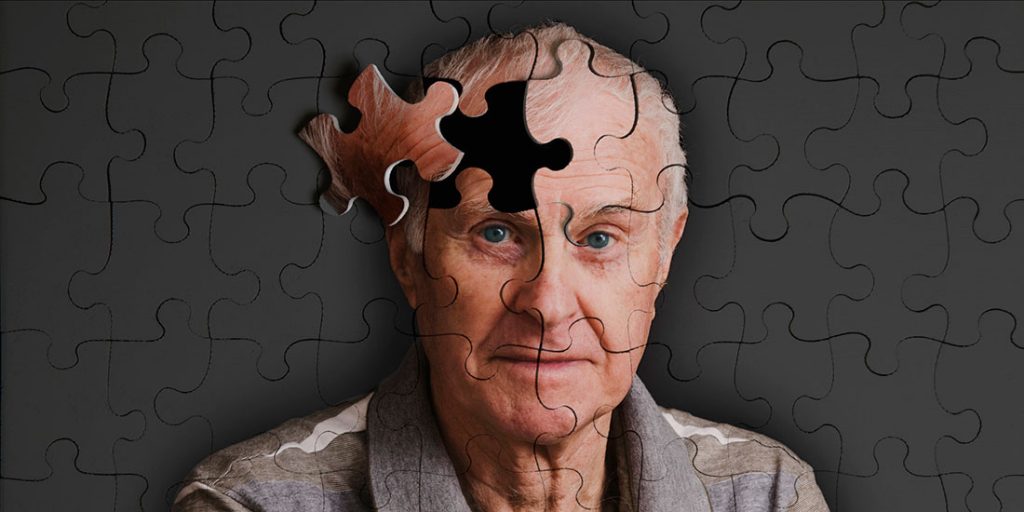 Enfermedad de Alzheimer