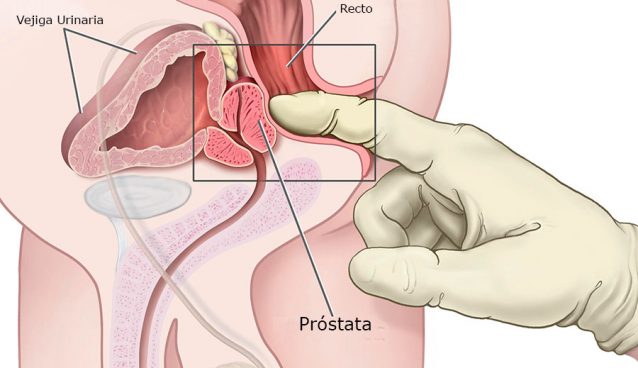 Próstata