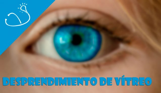 Desprendimiento de vítreo