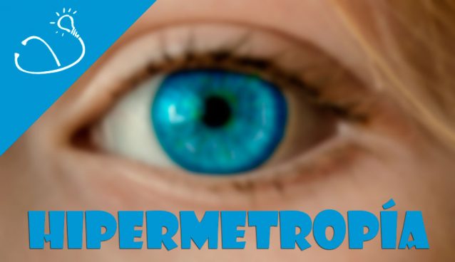 Hipermetropía