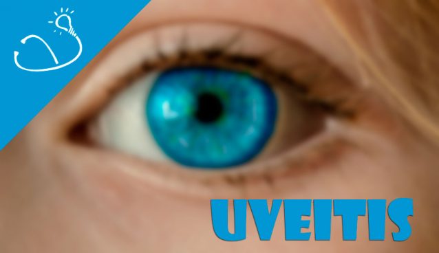 Uveitis