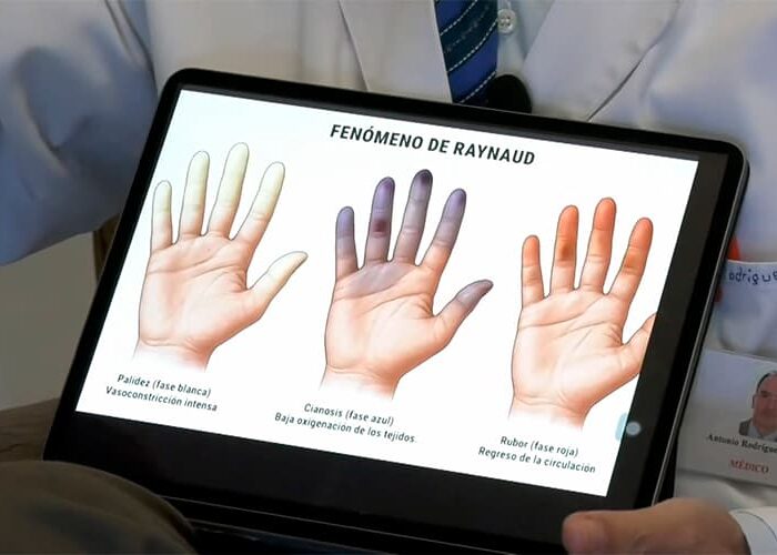 Hablamos sobre las patologías invernales en Canal Sierra de Cádiz